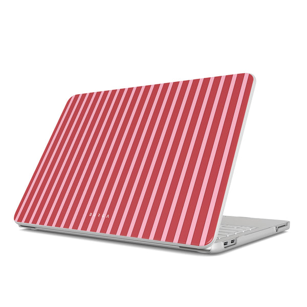 Strawberry Jam - Macbook Case